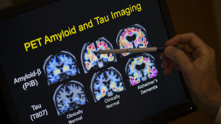 Who should see a neurologist first: the sick or the vulnerable?